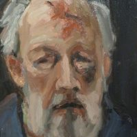 George Wallace - Self Portrait after Melanoma Surgery, oil painting